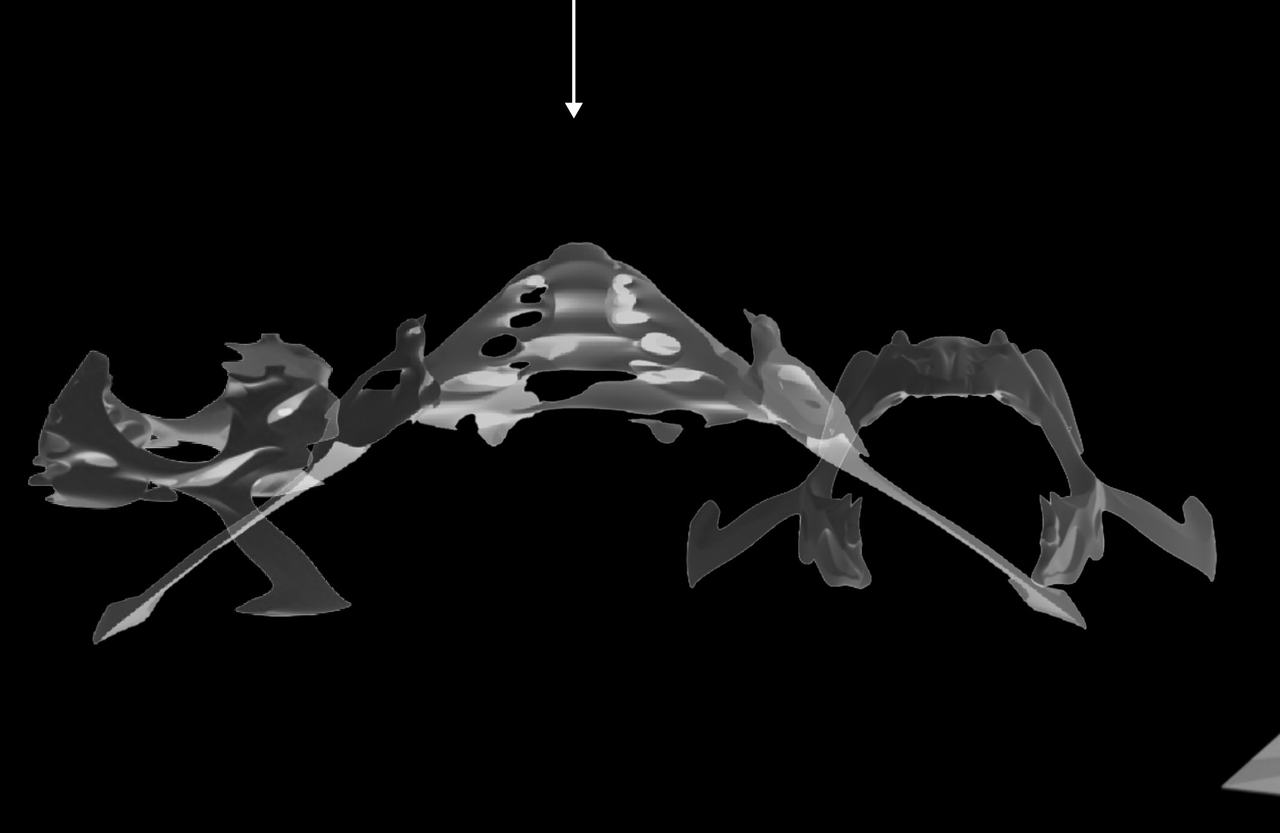 Gray 3D form combining the outlines of a female and a male pelvis into one winged silhouette.